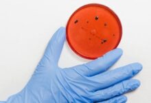 Ancaman Resistensi Antimikroba: Solusi Global untuk Masa Depan Kesehatan Kita