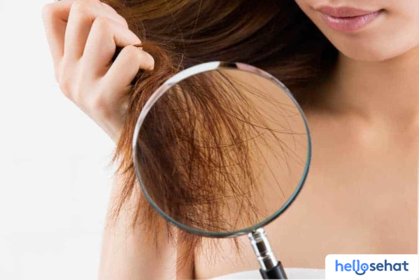 Atasi Rambut Bercabang: Penyebab & Solusi Ampuh Terbukti