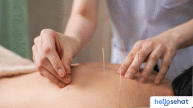 Rekomendasi 6 Klinik Akupuntur Terhebat di Medan & Sekitarnya