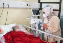 Tragis! Anak di Kebayoran Dianiaya Orangtua, Menteri PPPA Prihatin