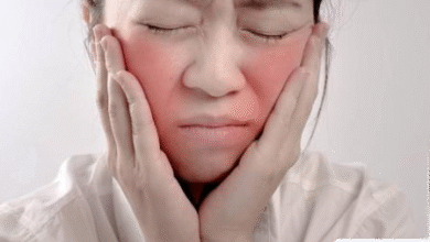 Wajah Merah? 8 Penyebab Medis Serius yang Harus Anda Tahu